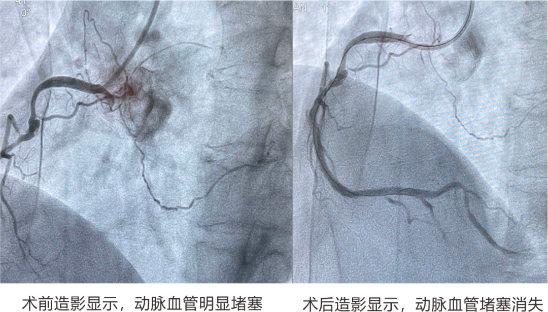 【保山安利醫(yī)院】冠心病——時(shí)刻警惕“人類(lèi)健康第一殺手”！